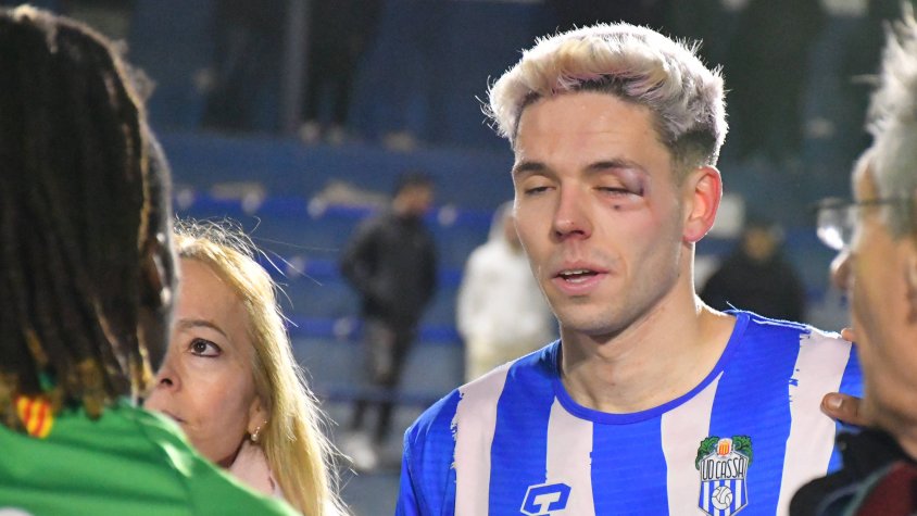 La cara de Notario reflecteix la brutalitat de l'atac